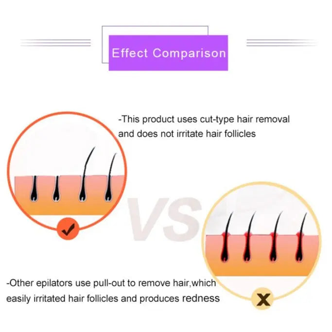 Painless Electric Laser Epilator For Women Health & Beauty-8