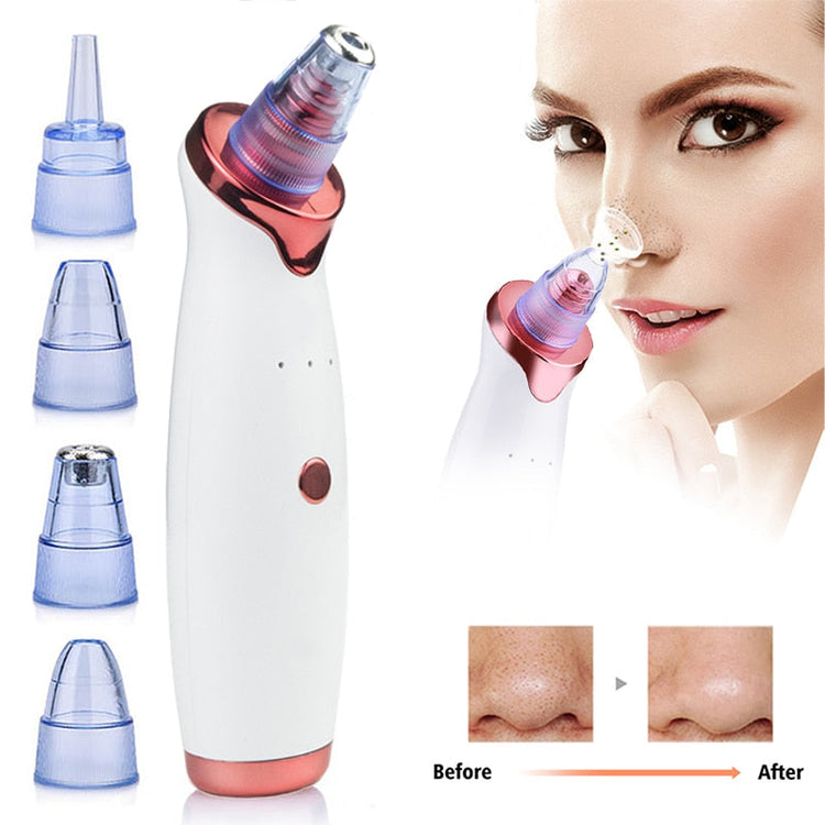 Electric Vacuum Facial Blackhead Remover Health & Beauty-6