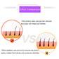 Painless Electric Laser Epilator For Women Health & Beauty-8