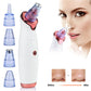 Electric Vacuum Facial Blackhead Remover Health & Beauty-6