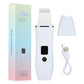 Ultrasonic Skin Scrubber Peeling Blackhead Remover Mia Vita
