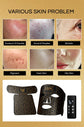 LED Anti-Aging, Acne Fighting & Skin Rejuvenation Therapy Glan Mia